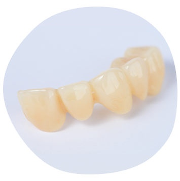 セラミックとは