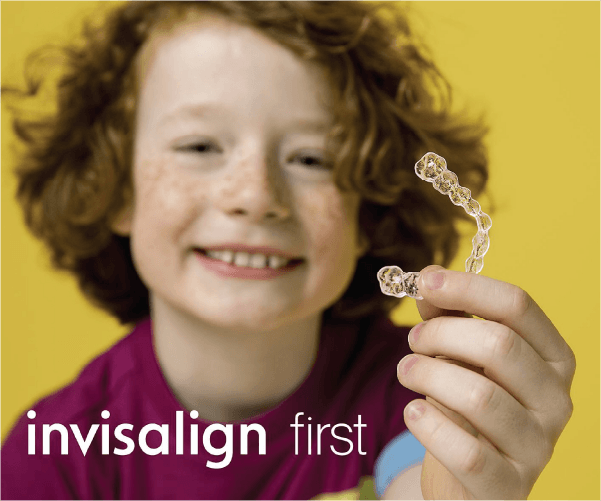 インビザライン・ファースト